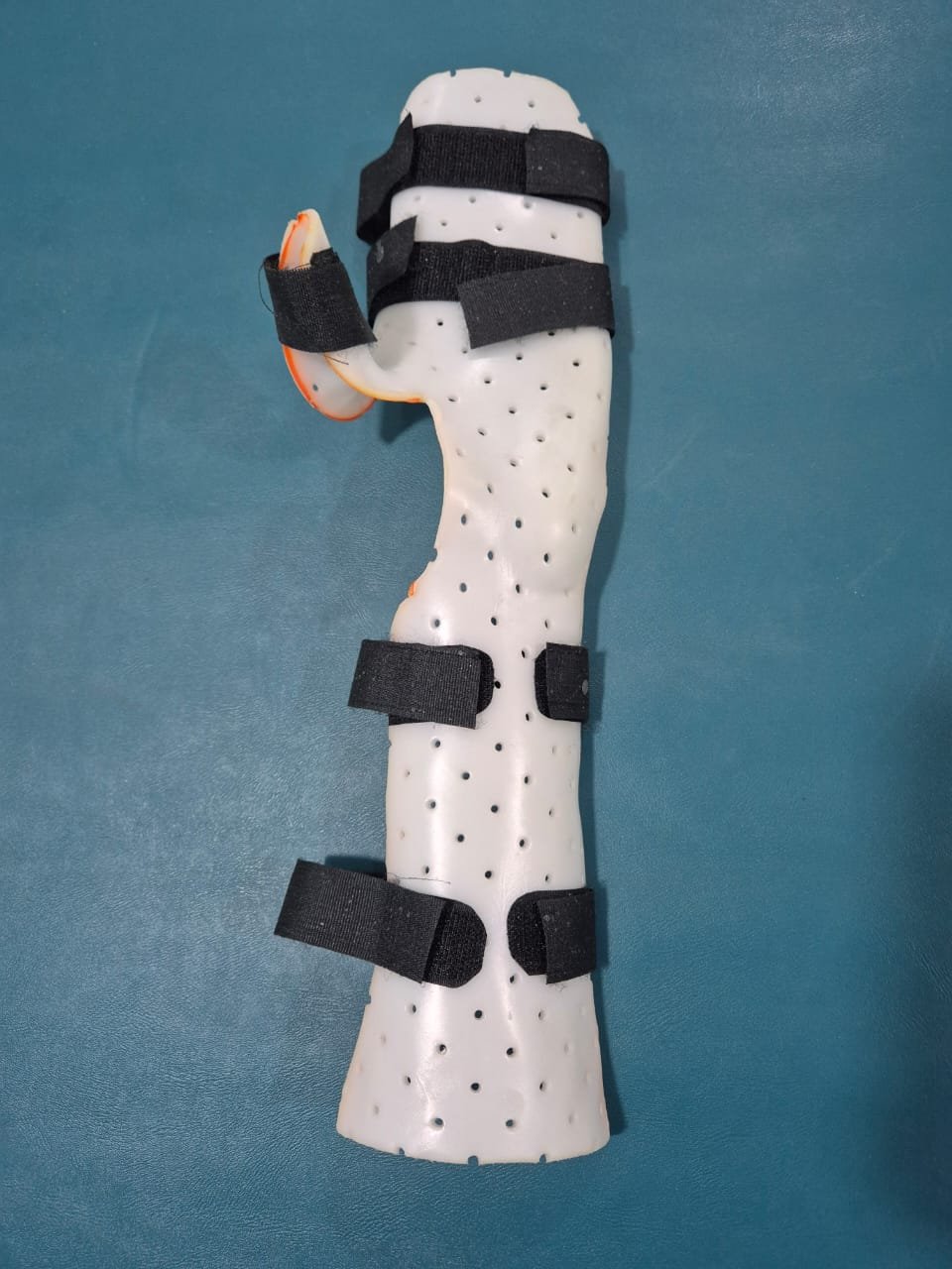 Custom thermoplastic hand orthosis design