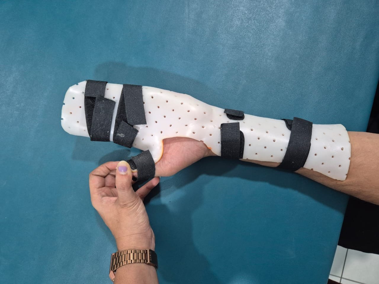 Resting hand splint for post-operative support